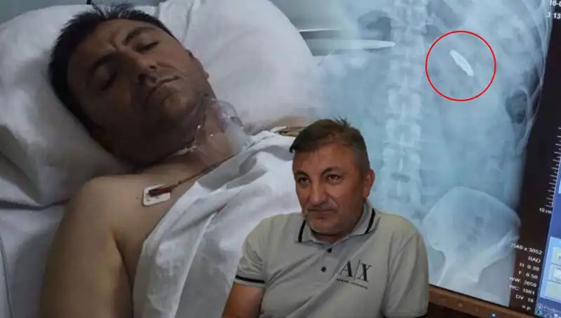 15 Temmuz’un Karanlık Yüzü: Kurşunla Yaralanan Gazi'nin Hikayesi